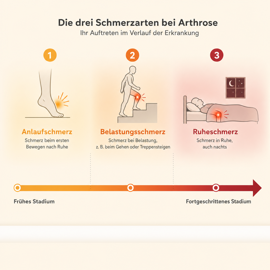Infografik: Die drei Arthrose-Schmerztypen im zeitlichen Verlauf – Anlaufschmerz, Belastungsschmerz, Ruheschmerz.
